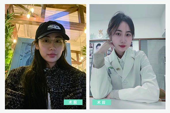 营口何氏眼科医院员工摘镜日记   第七期